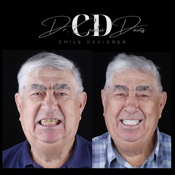 Smiling patient at Dental Arts Nogales showing their transformed smile after dental treatment by Dr. Cantú Davis.