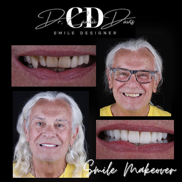 Smiling patient at Dental Arts Nogales showing their transformed smile after dental treatment by Dr. Cantú Davis.